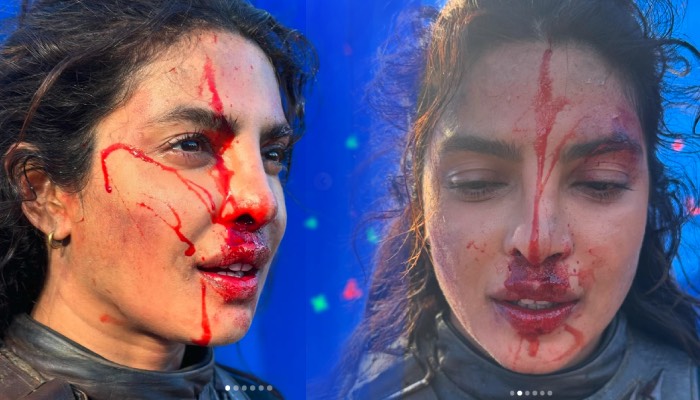 खून से लथपथ दिखीं Priyanka Chopra, Actress की हालत देख डर गए Fans !