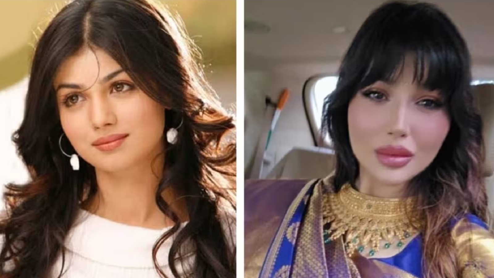 Ayesha Takia को प्लास्टिक सर्जरी कराना पड़ा भारी, लोगों ने बुरी तरह किया Troll !